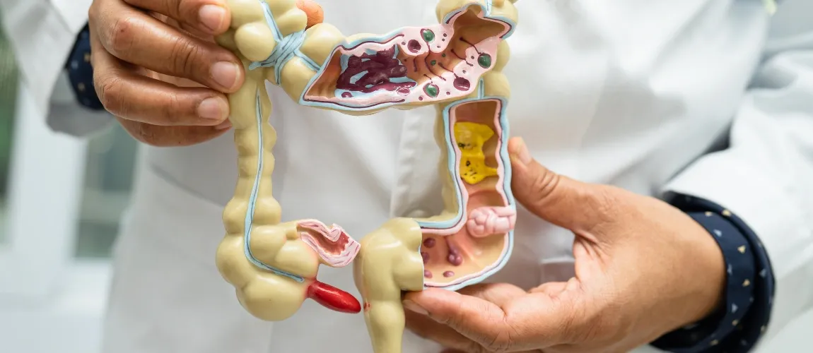 Arzt hält anatomisches Modell des Verdauungstraktes in der Hand