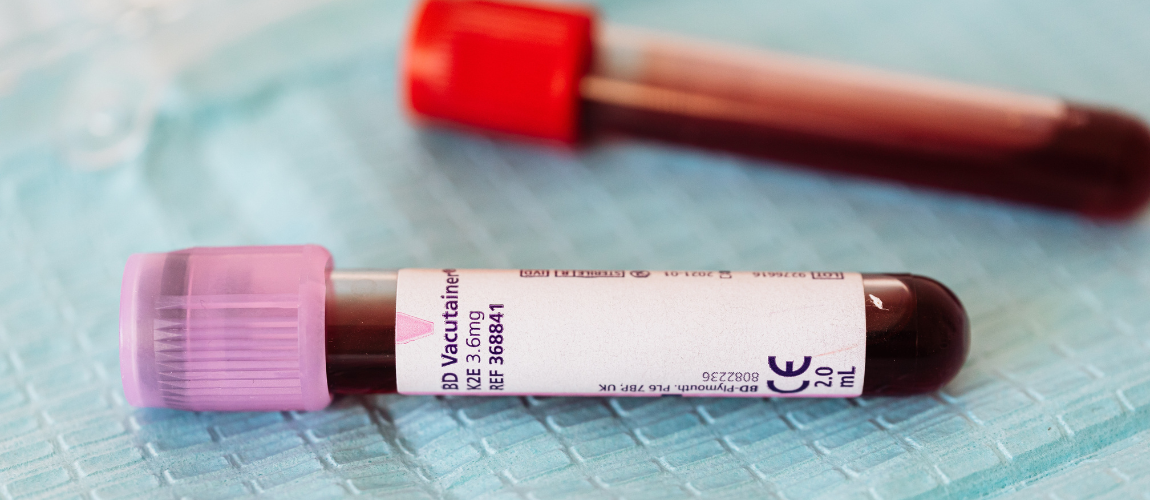 Zwei mit Blut gefüllte Röhrchen liegen auf einer Unterlage.